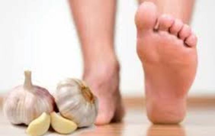 Priyanka Chopra Jonas massages her feet with garlic